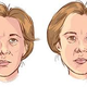 Illustration for article titled Obat Gejala Stroke Ringan Alamiem/em